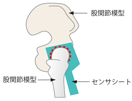 関節置換術、THA